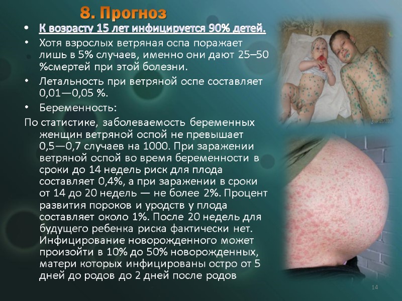 8. Прогноз К возрасту 15 лет инфицируется 90% детей.  Хотя взрослых ветряная оспа